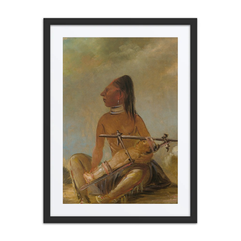 Woman and Child: Flattening of Infant Heads